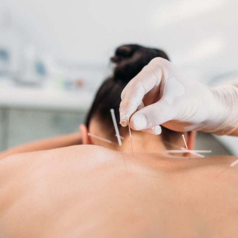 Acupuncture-Blog-980x654